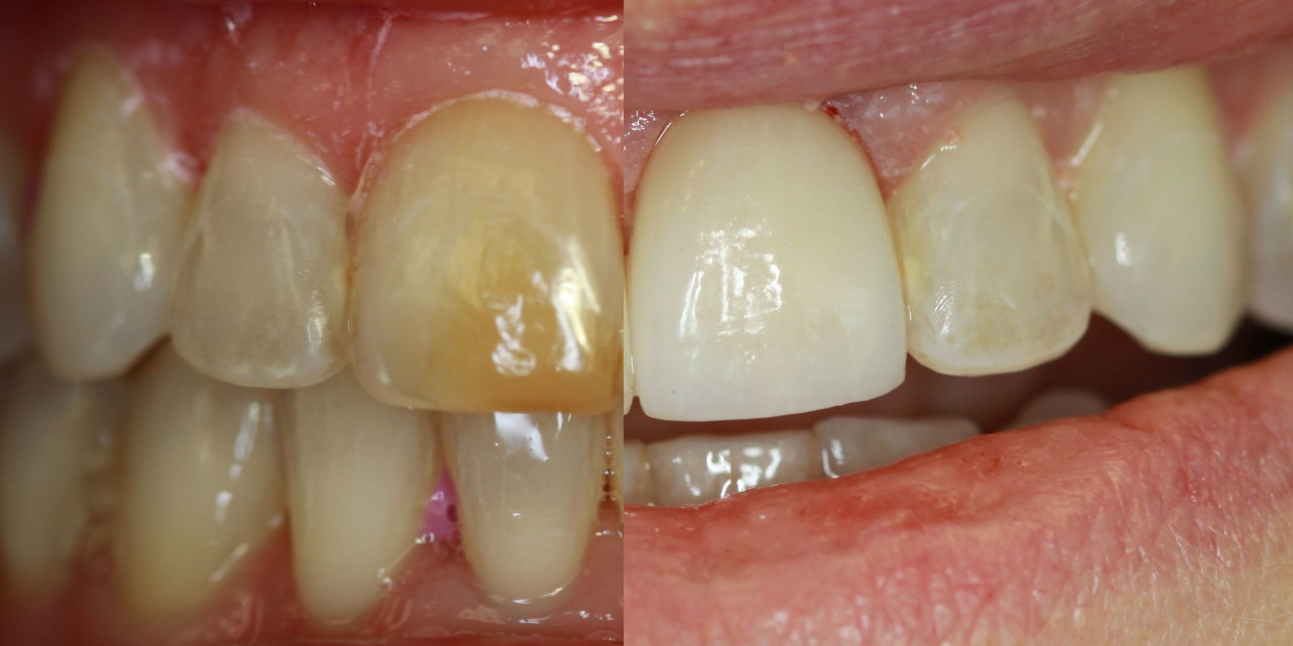 before and after cosm