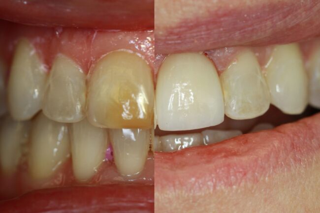 before and after cosm